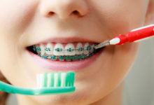 كيفية تنظيف الأسنان مع التقويم